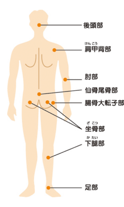 床ずれのできやすい場所