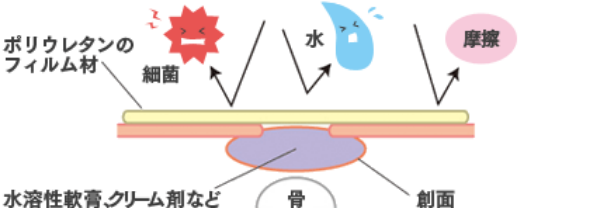 局所療法：閉鎖性ドレッシング法